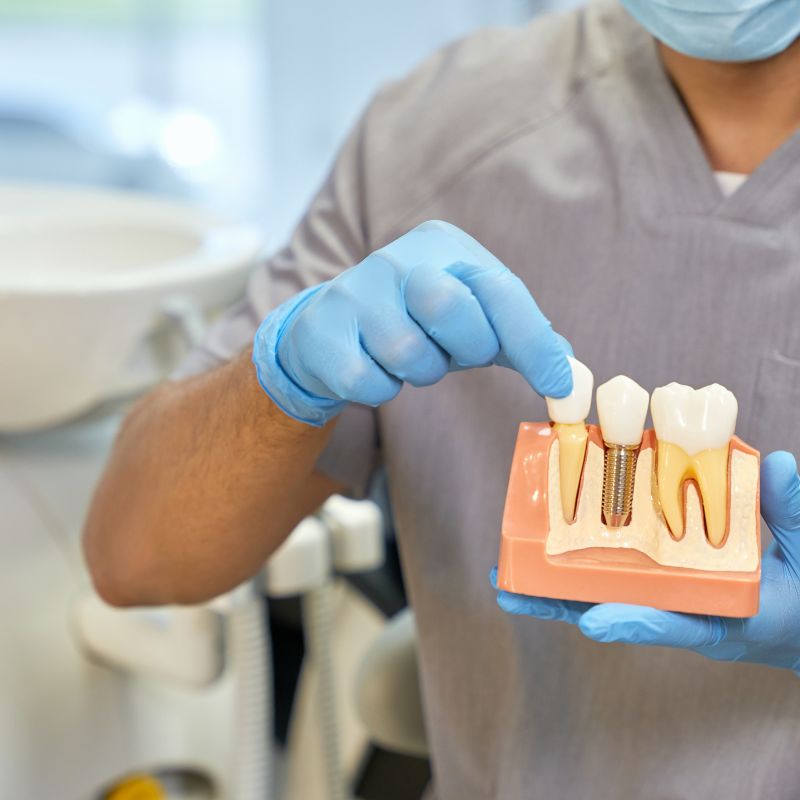 Dentures