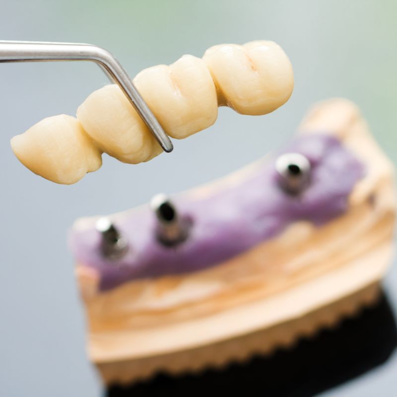 Azad Dentals Patna (15)