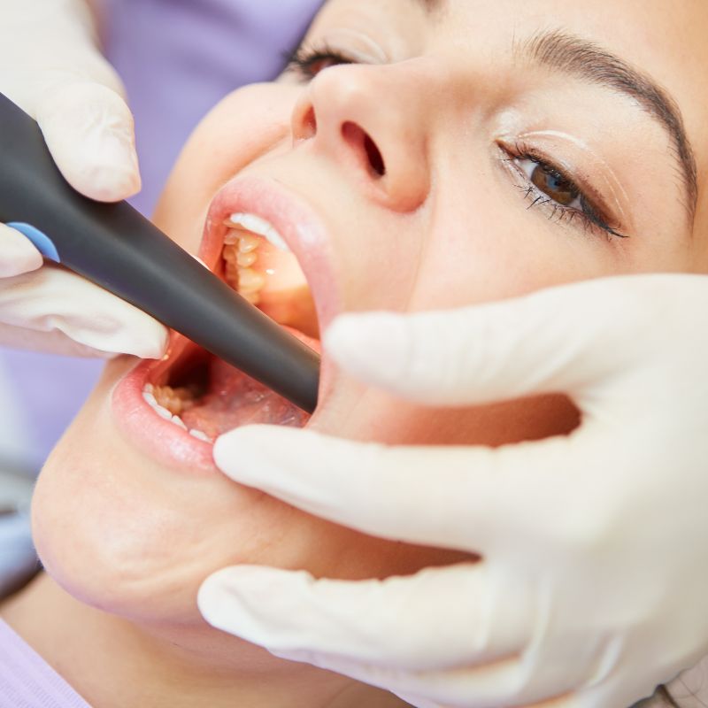 Dental mouth guard for protection