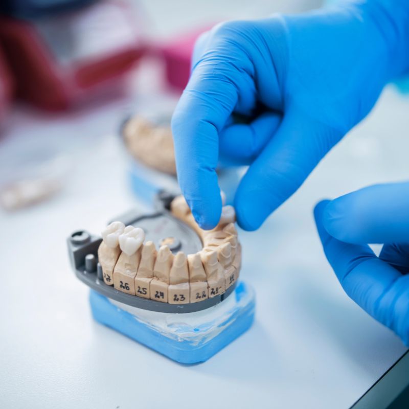 Dental mouth guard for protection