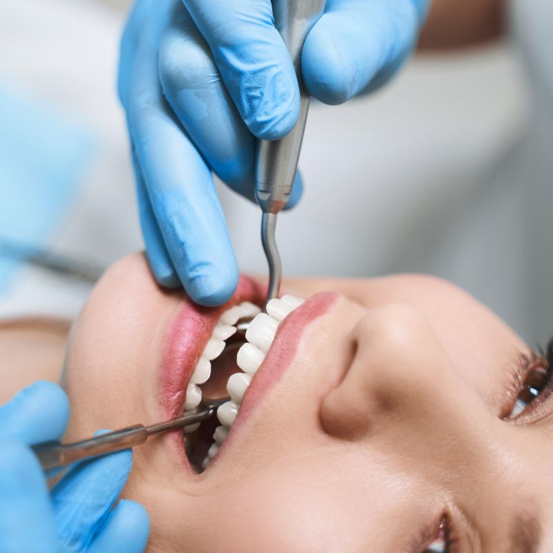 Dental mouth guard for protection