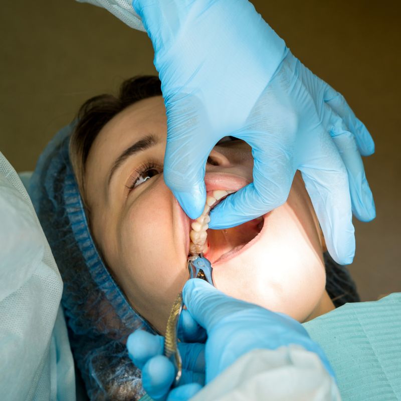 Dental mouth guard for protection