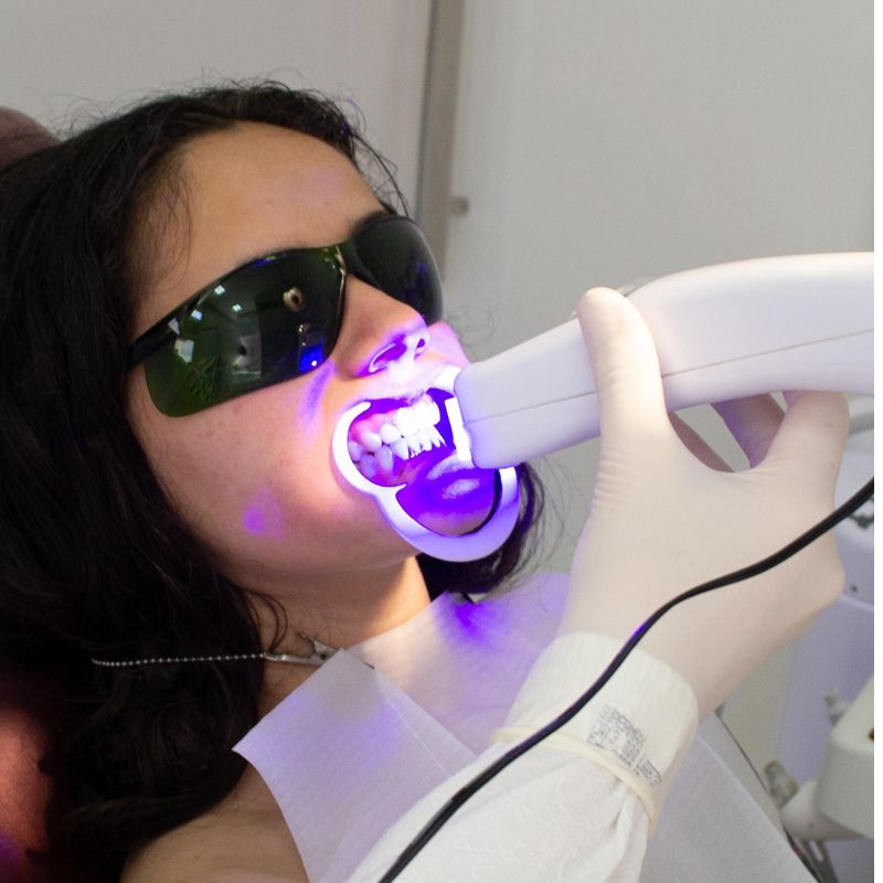 Dental mouth guard for protection